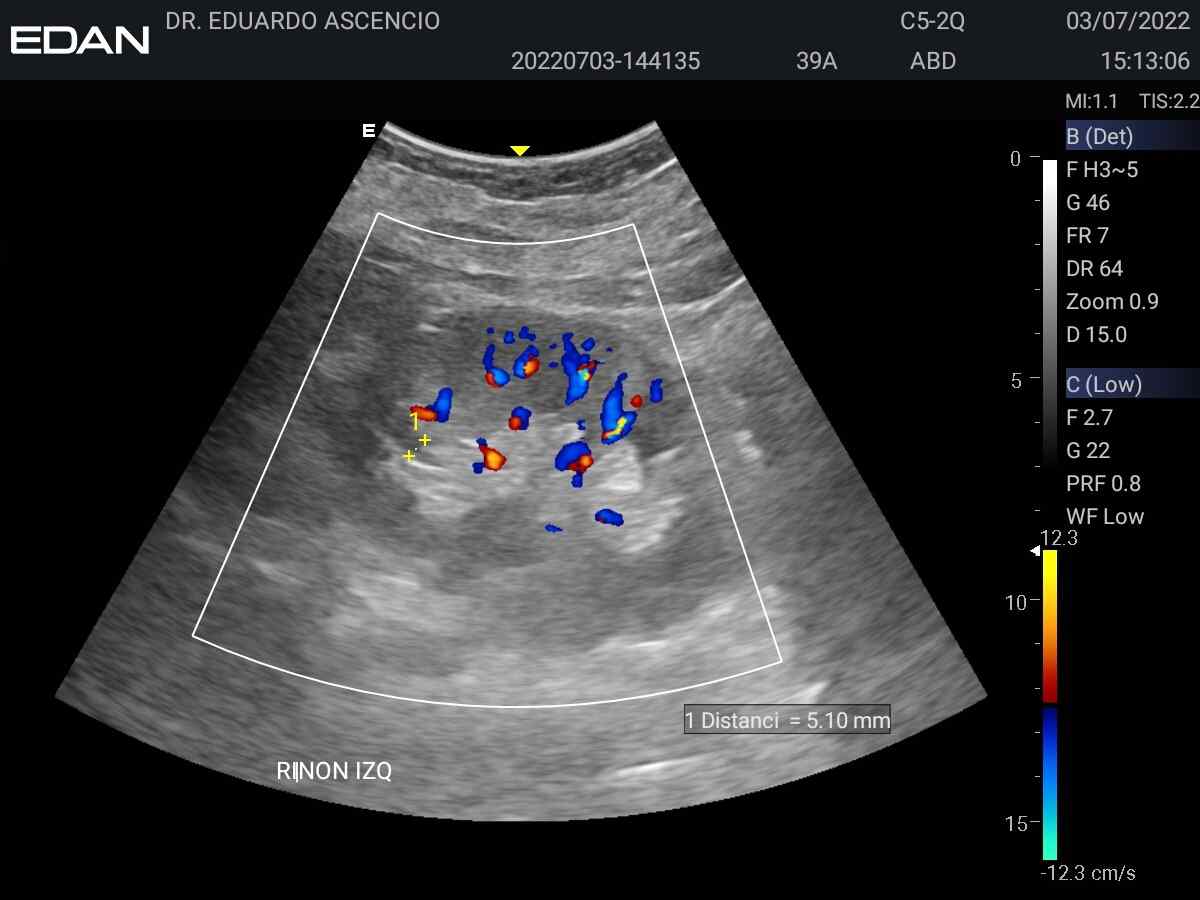Renal.jpeg