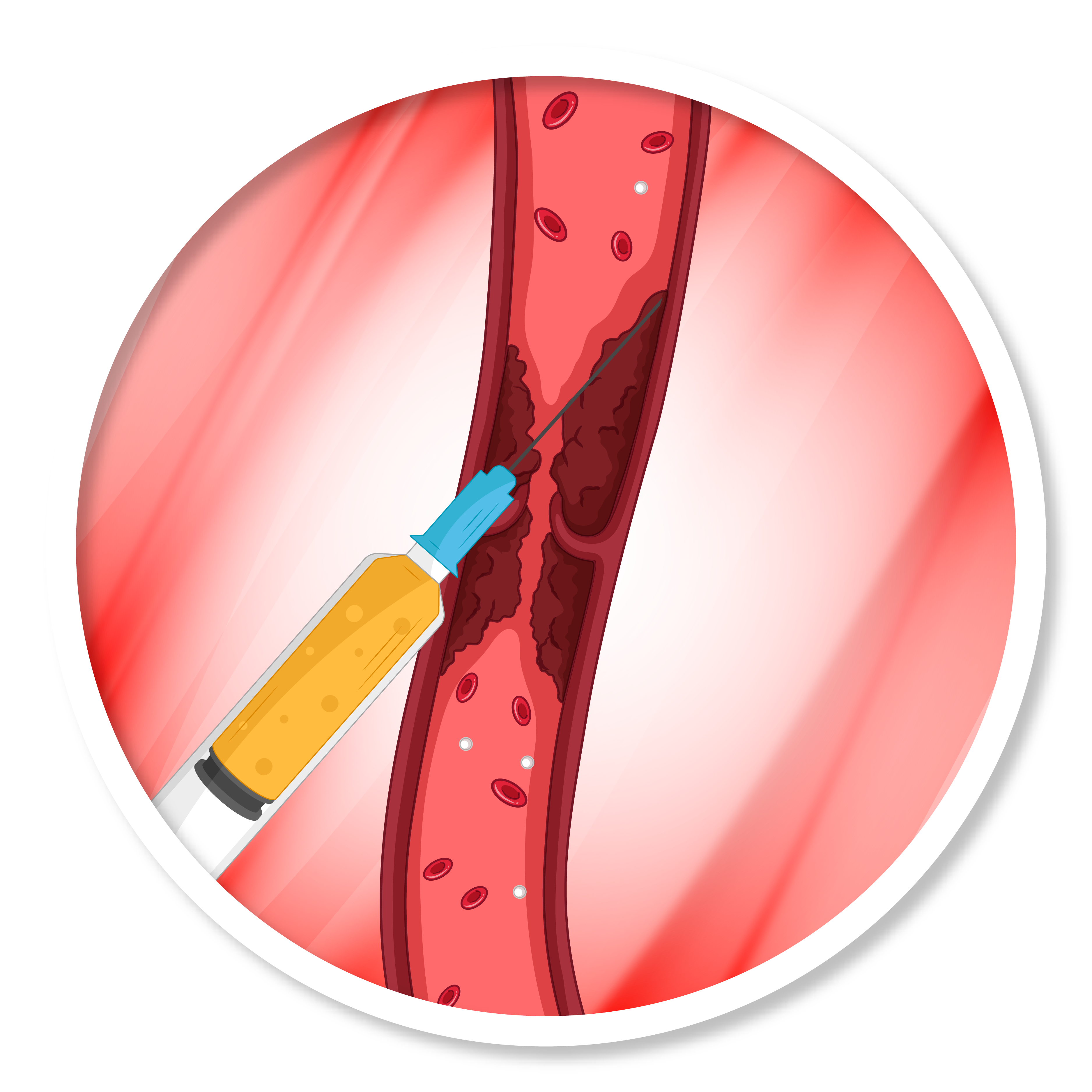 proceso felboterapia regenerativa_ -02.png