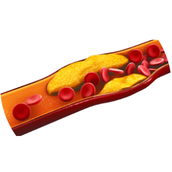 colesterol2.png